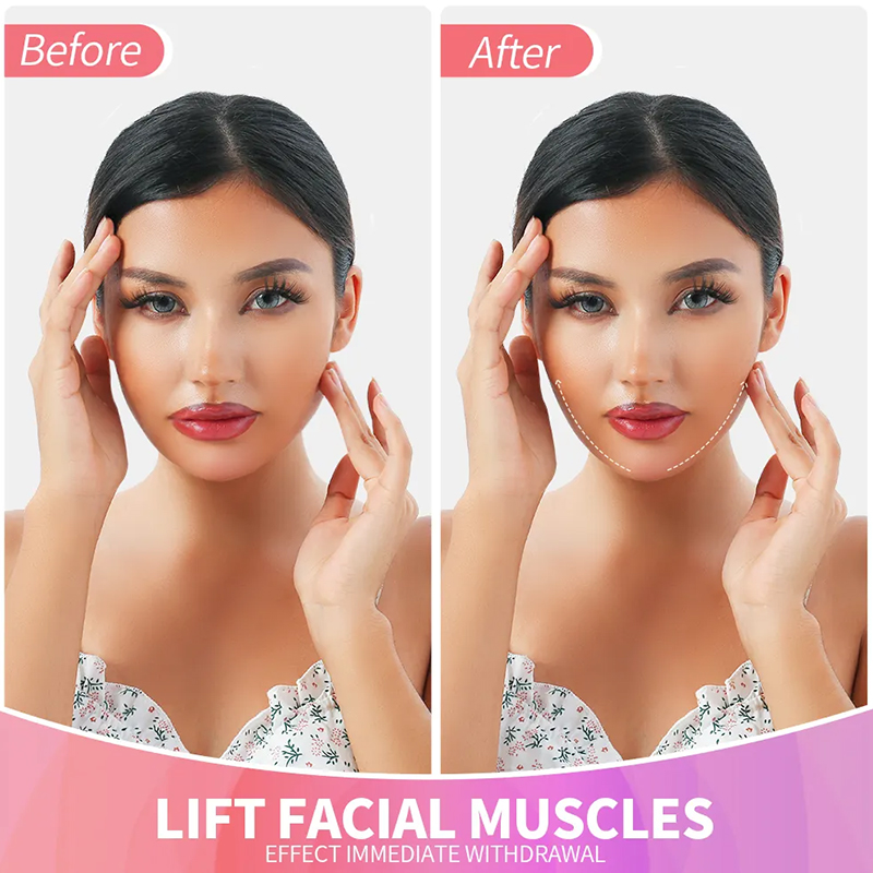 Invisible Face Lifting Tape before and after