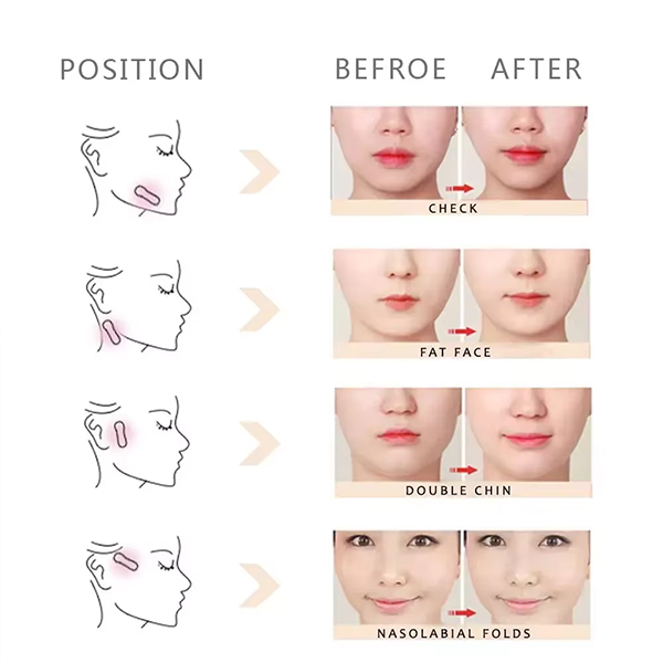face lifting tape beauty tools to help eliminate wrinkles
