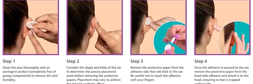 Ear Correction Stickers 2025 easy use