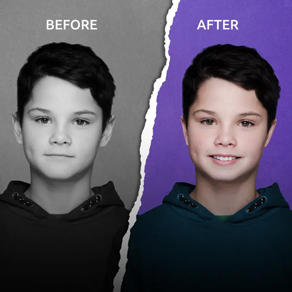 before and after ear correction