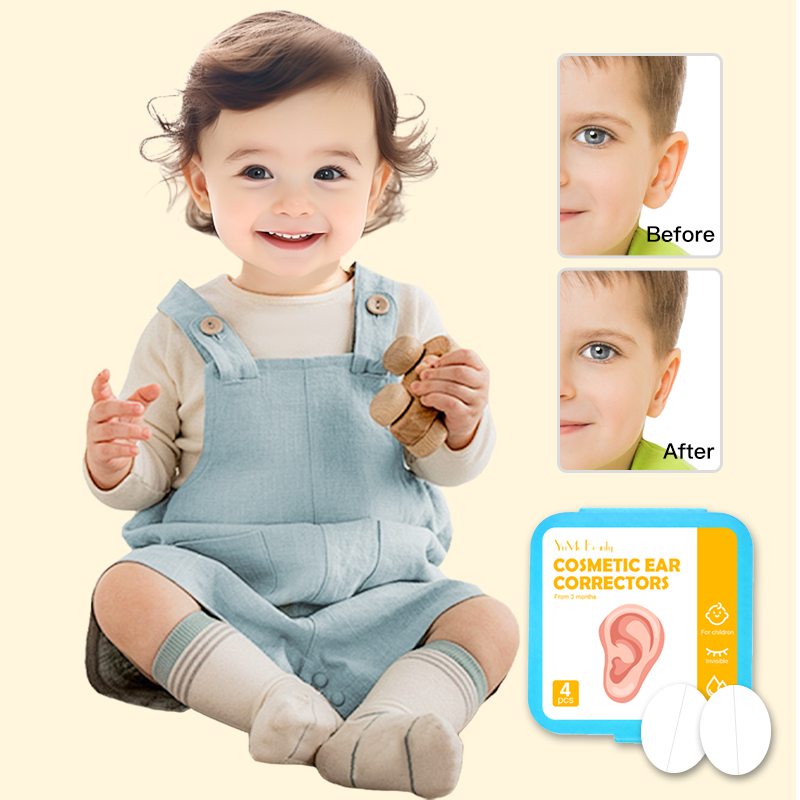 before and after ear correction for baby
