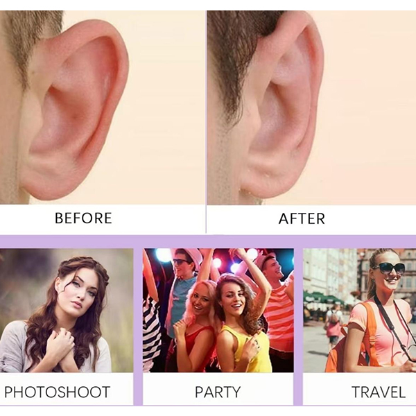 Benefits of Ear Correction YumeBeauty