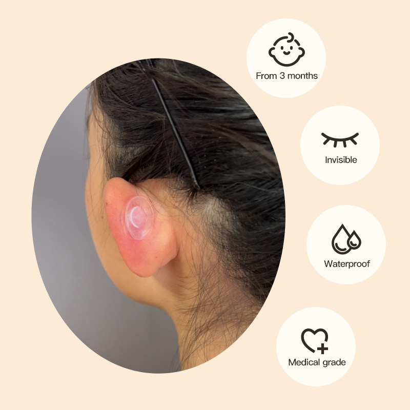 baby ear corrector from 3 months solves big ear problem
