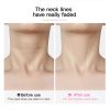 instant neck lift tape anti wrinkle lifting sticker