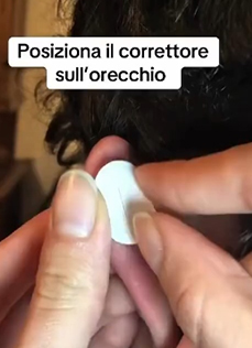 Ear Correction Patches – Fix Protruding Ears Painlessly & Invisibly