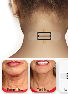 Neck Wrinkle Patches – Smooth Fine Lines, Lift Neck Firmly