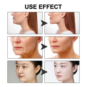 adhesive-v-shape-face-lift-tape-for-jawline